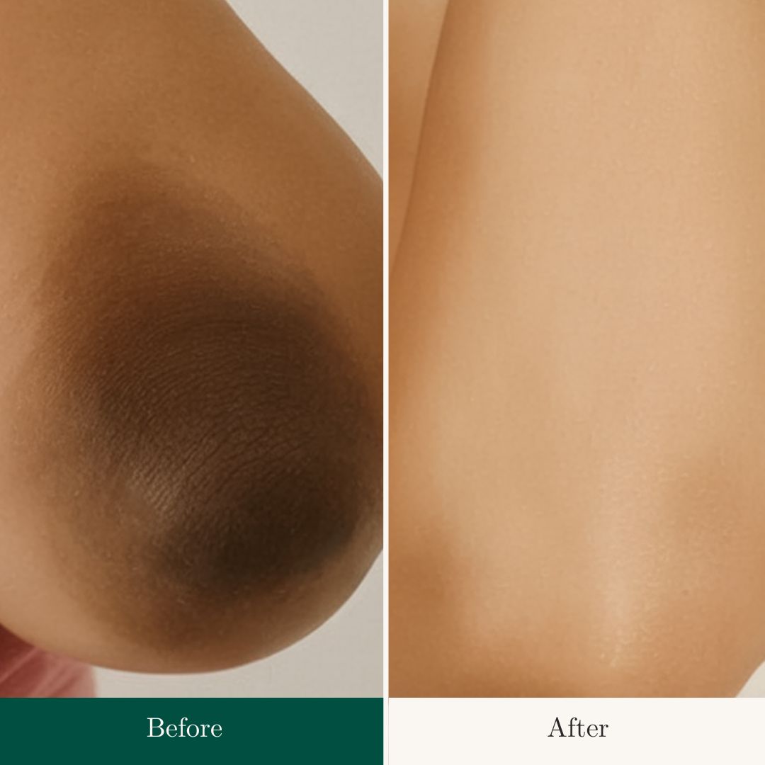 Before After 8